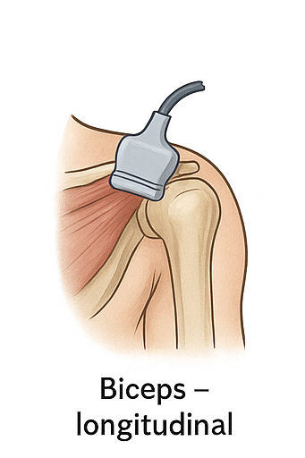 Bíceps longitudinal