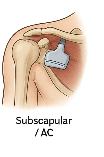 Subescapular / Articulación acromioclavicular